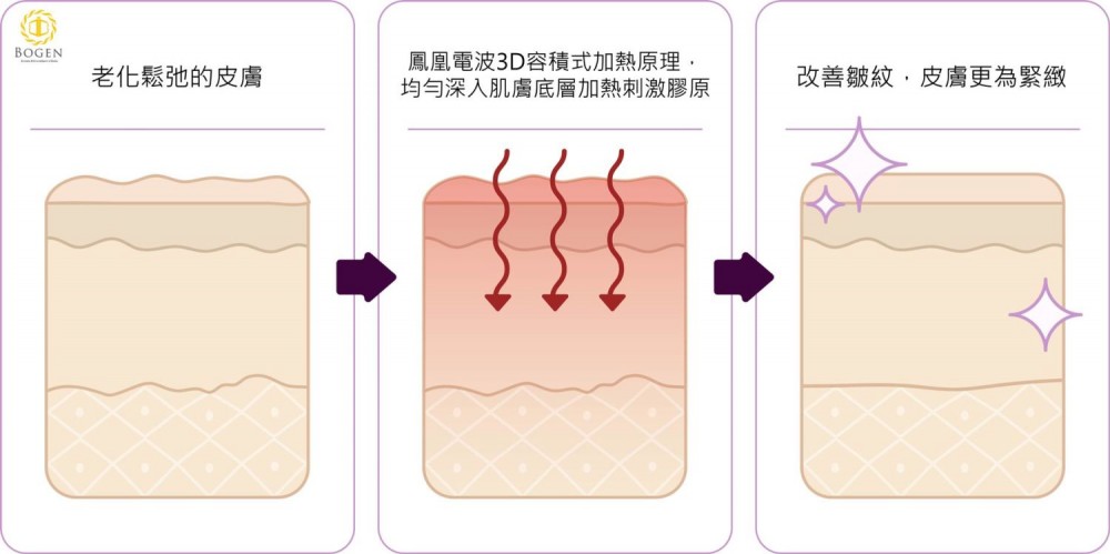 鳳凰電波探頭效果,鳳凰電波原理,鳳凰電波,博恩妍